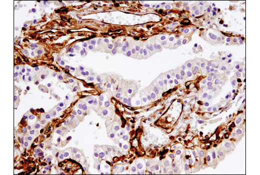 Fascin (55K-2) Mouse mAb (IHC Formulated)