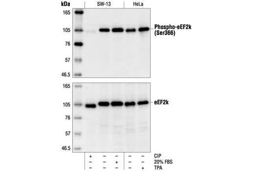 Phospho-eEF2k (Ser366) Antibody