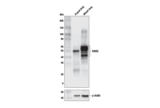 RAGE Antibody