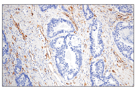 IGFBP7 (E3Z8L) XP Rabbit mAb