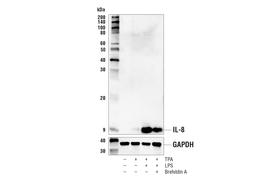 IL-8 (E5F5Q) Rabbit Monoclonal Antibody