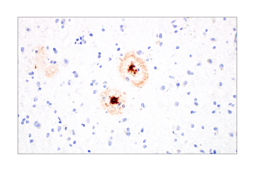 beta-Amyloid (1-42) (E6D5M) Rabbit mAb