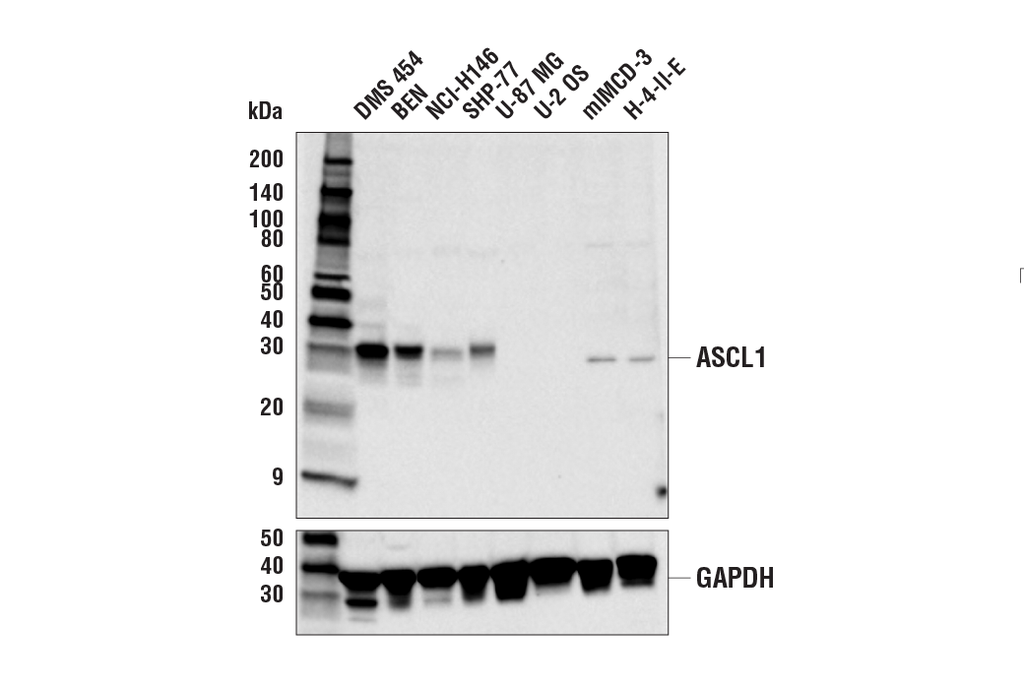 ASCL1 (E6Y1B) Rabbit mAb