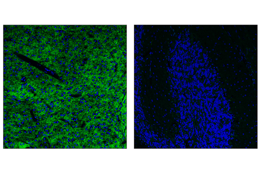 Dopamine D(2) Receptor/D2R (E1U8K) Rabbit mAb