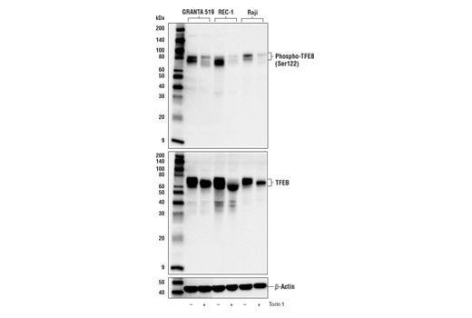 Phospho-TFEB (Ser122) Antibody