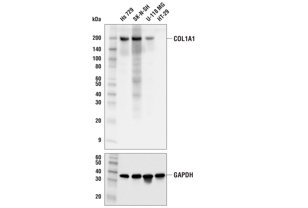 COL1A1 (E3E1X) Mouse mAb