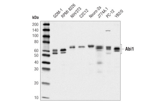 IL-2Rα/CD25 (E9W2J) XP Rabbit mAb