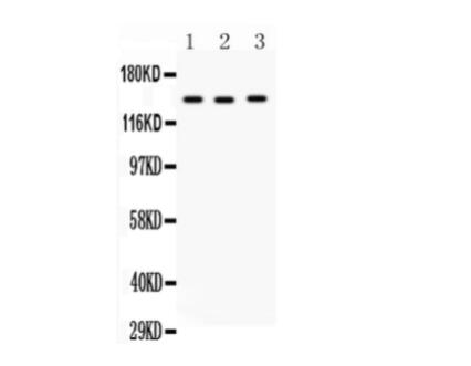 [058.PA5-79941] RTN3 Polyclonal Antibody [100ug]