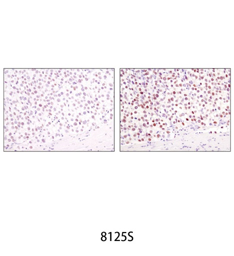 [003.8125S] SignalStain Boost IHC Detection Reagent (HRP Mouse) [15ml]