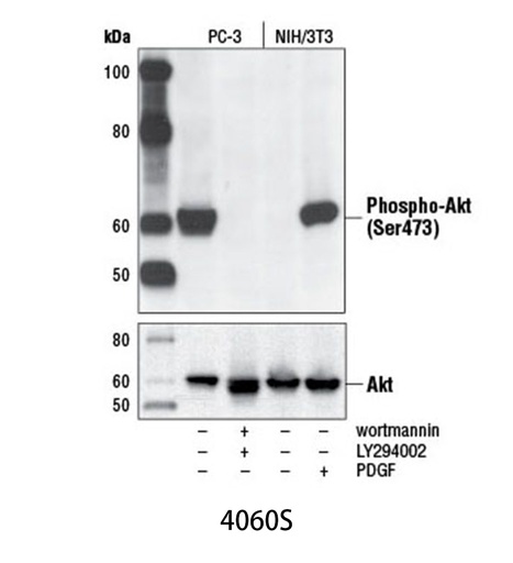 [003.4060S] Phospho-Akt (Ser473) (D9E) XP Rabbit mAb [100ul]