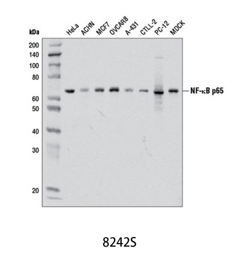 [003.8242S] NF-κB p65 (D14E12) XP Rabbit mAb [100ul]