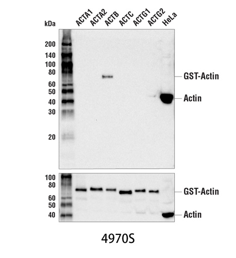 [003.4970S] β-Actin (13E5) Rabbit mAb [100ul]