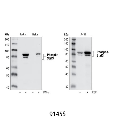 [003.9145S] Phospho-Stat3 (Tyr705) (D3A7) XP Rabbit mAb [100ul]