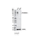 Epithelial-Mesenchymal Transition (EMT) Antibody Sampler Kit