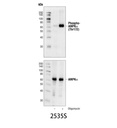 Phospho-AMPKα (Thr172) (40H9) Rabbit mAb