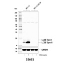 LC3B (D11) XP Rabbit mAb