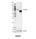 β-Catenin (D10A8) XP Rabbit mAb