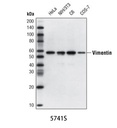 Vimentin (D21H3) XP Rabbit mAb