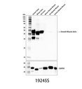 α-Smooth Muscle Actin (D4K9N) XP Rabbit mAb