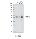 β-Tubulin (9F3) Rabbit mAb
