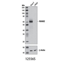 RUNX2 (D1L7F) Rabbit mAb