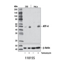 ATF-4 (D4B8) Rabbit mAb