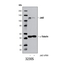 Jak2 (D2E12) XP Rabbit mAb