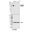 Androgen Receptor (D6F11) XP Rabbit mAb