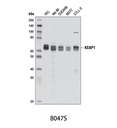 KEAP1 (D6B12) Rabbit mAb