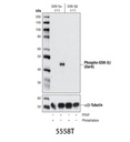 Phospho-GSK-3β (Ser9) (D85E12) XP Rabbit mAb
