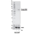 Phospho-SMAD2 (Ser465/Ser467) (E8F3R) Rabbit mAb