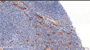 Anti-CD31 antibody