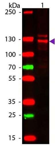 [017.ab34710] Anti-Collagen I antibody [100 µg]