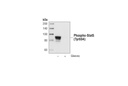 Phospho-Stat5 (Tyr694) (C11C5) Rabbit mAb