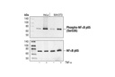 Phospho-NF-κB p65 (Ser536) (93H1) Rabbit mAb