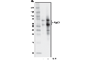 MAVS (D5A9E) Rabbit mAb