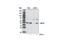 IRF-8 (D20D8) Rabbit mAb
