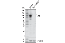 Alix (E6P9B) Rabbit mAb