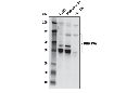 DNMT3A (D2H4B) Rabbit mAb