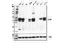 EpCAM (E6V8Y) XP Rabbit mAb (Mouse Preferred)