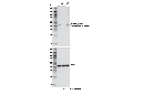 Phospho-Pyruvate Dehydrogenase α1 (Ser293) Antibody