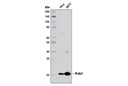 Prdx1 (D5G12) Rabbit mAb