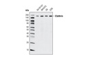 Clathrin Heavy Chain (D3C6) XP Rabbit mAb