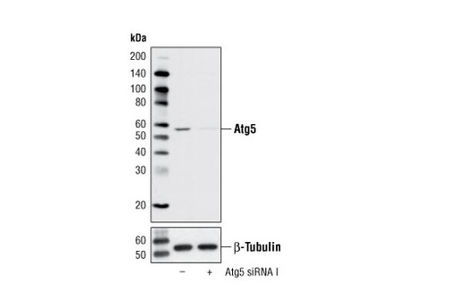[003.6345S] SignalSilence Atg5 siRNA I [300ul]