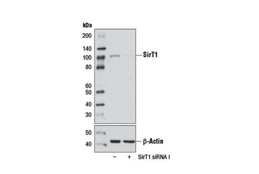 [003.12241S] SignalSilence SirT1 siRNA I [300ul]