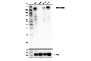 CD11b/ITGAM (D6X1N) Rabbit mAb