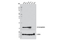 β2-microglobulin (D8P1H) Rabbit mAb