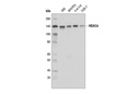 HDAC4 (D8T3Q) Rabbit mAb