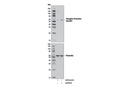 Phospho-Vimentin (Ser83) (D5A2D) Rabbit mAb
