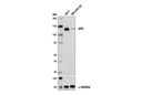 XPC (D1M5Y) Rabbit mAb